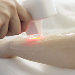 パワーライト美肌脱毛